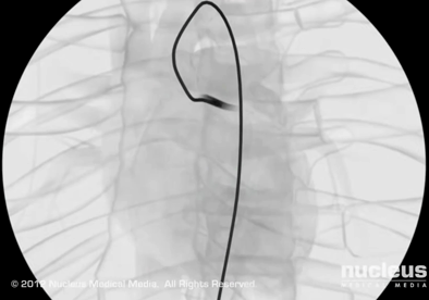 Klassiki stefaniografia Klassiki stefaniografia