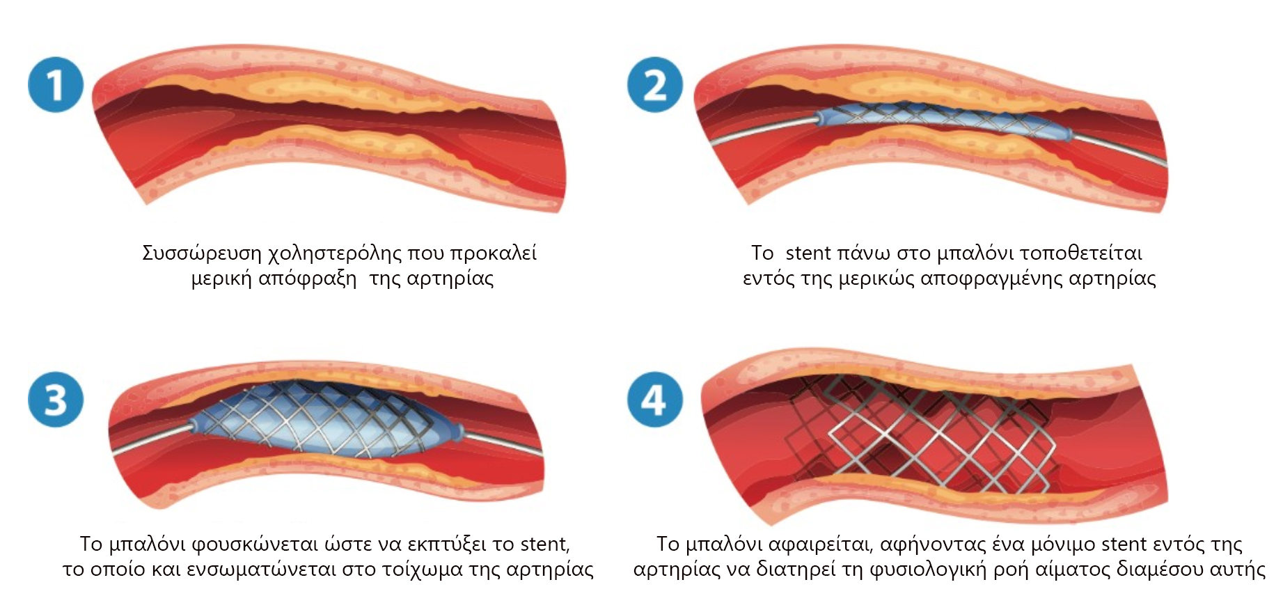 Ageioplastiki (3)